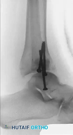 Hutaifortho's Orthopaedic Diagram