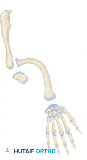 Ulnar Clubhand & Deficiencies: Surgical Management Guide