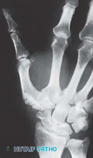 تقييم شعاعي وتشريحي