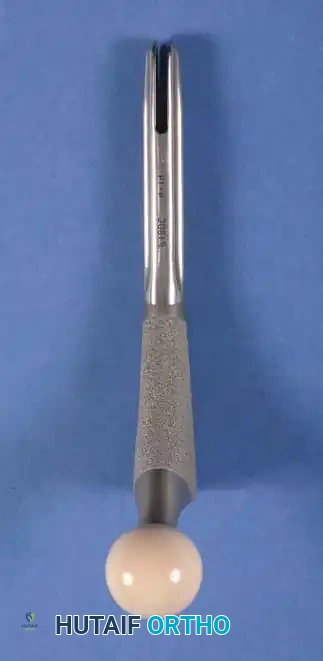 صورة إشعاعية توضيحية للمفصل