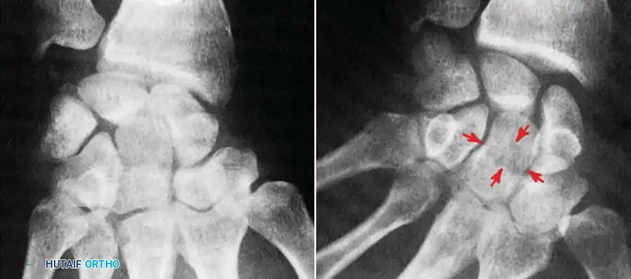 DIAGNOSIS OF WRIST CONDITIONS Surgical Diagram
