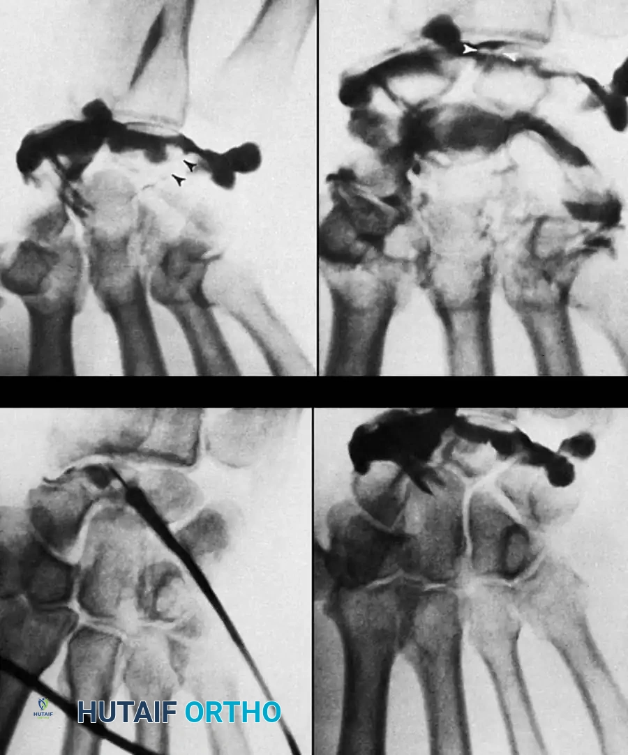 DIAGNOSIS OF WRIST CONDITIONS Surgical Diagram