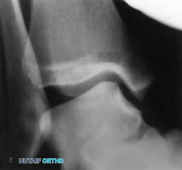 DIAGNOSIS Surgical Diagram