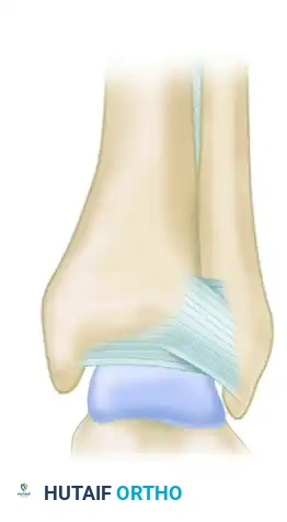 DIAGNOSIS Surgical Diagram