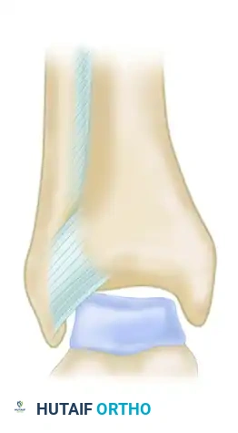 DIAGNOSIS Surgical Diagram