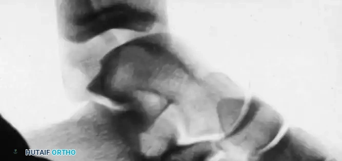 DIAGNOSIS Surgical Diagram