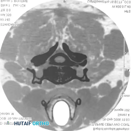 DIAGNOSTIC STUDIES Surgical Diagram