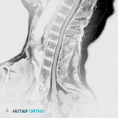 Diagnostic Imaging in Spinal Orthopaedics: A Clinical Guide
