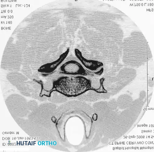 DIAGNOSTIC STUDIES Surgical Diagram