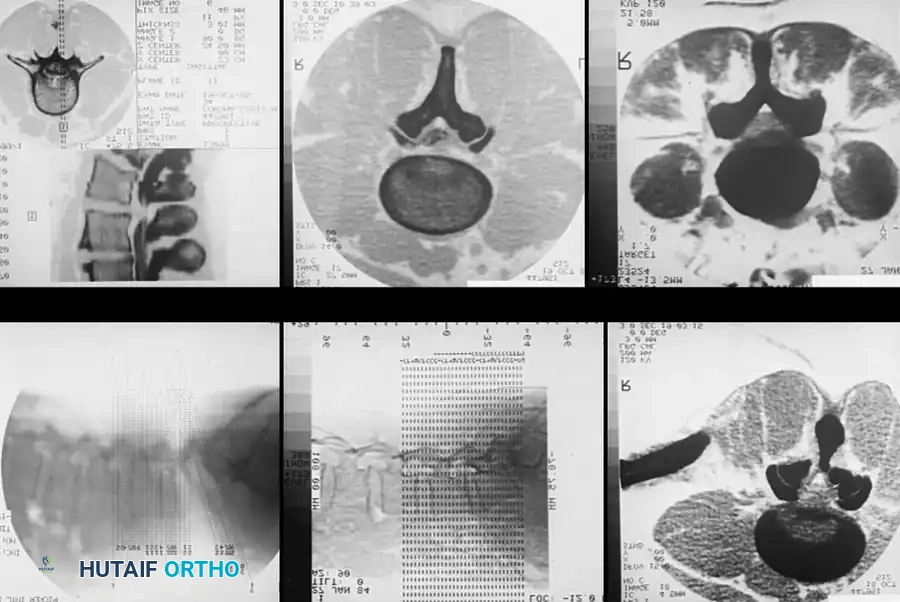 DIAGNOSTIC STUDIES Surgical Diagram