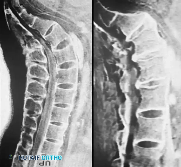 DIAGNOSTIC STUDIES Surgical Diagram