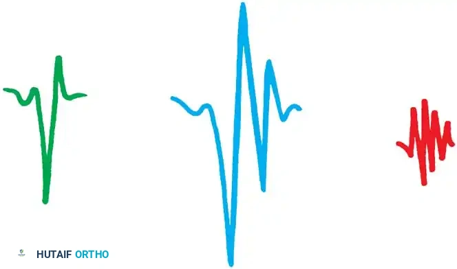 DIFFERENTIATION OF MUSCLE DISEASE FROM NERVE DISEASE Surgical Diagram