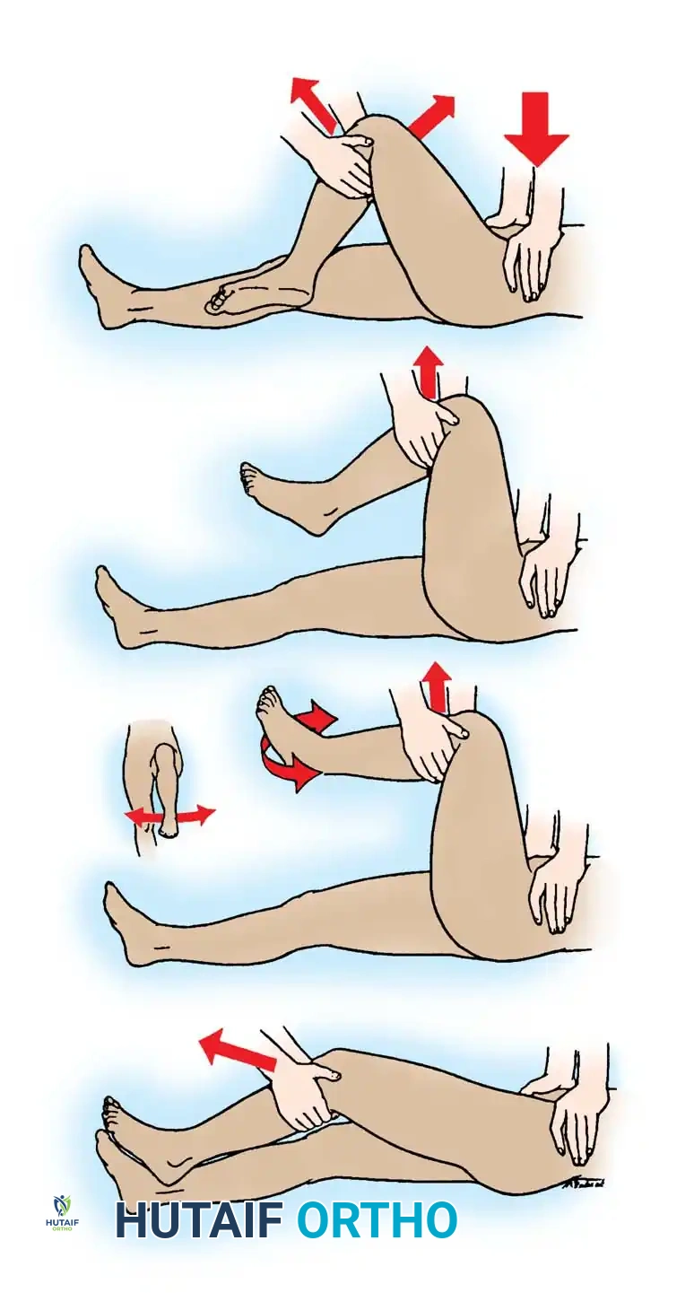 DISLOCATION AND FRACTUREDISLOCATION OF THE HIP Surgical Diagram