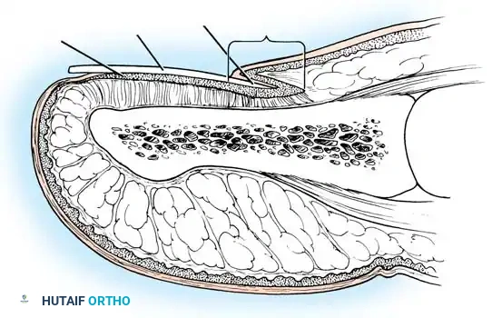 Operative Management of Ingrown Toenails: A Comprehensive Surgical Guide