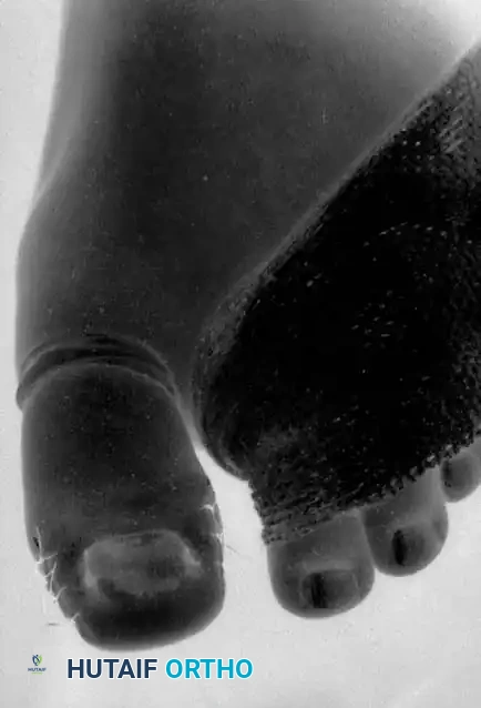 Hutaifortho's Orthopaedic Diagram