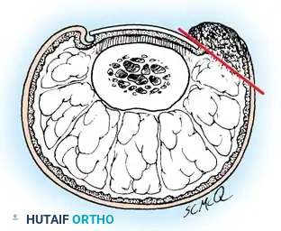 Hutaifortho's Orthopaedic Diagram