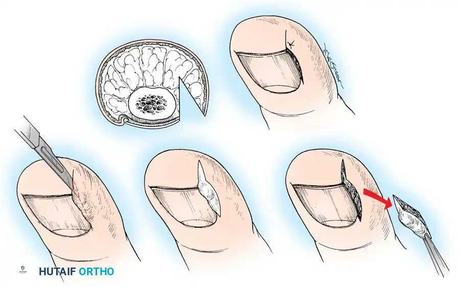 Hutaifortho's Orthopaedic Diagram