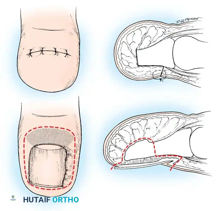Hutaifortho's Orthopaedic Diagram