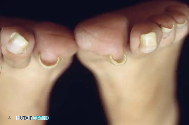 Hutaifortho's Orthopaedic Diagram