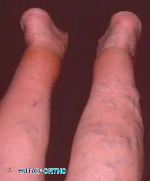 Hutaifortho's Orthopaedic Diagram