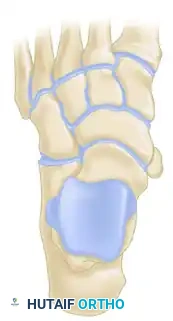 Exposure of PTT and Accessory Navicular