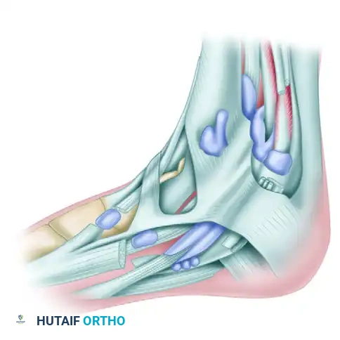 Bursa under anterior tibial tendon