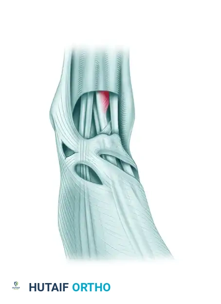 Anterior tibial tendon retinaculum split