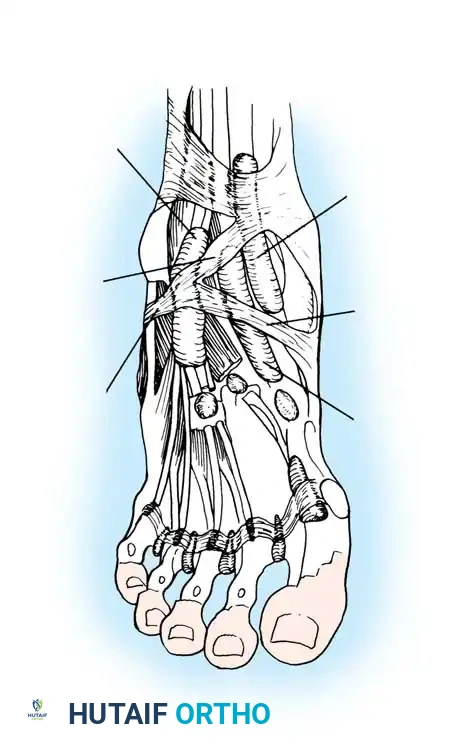 Disorders of the Anterior Tibial Tendon: A Comprehensive Surgical Guide
