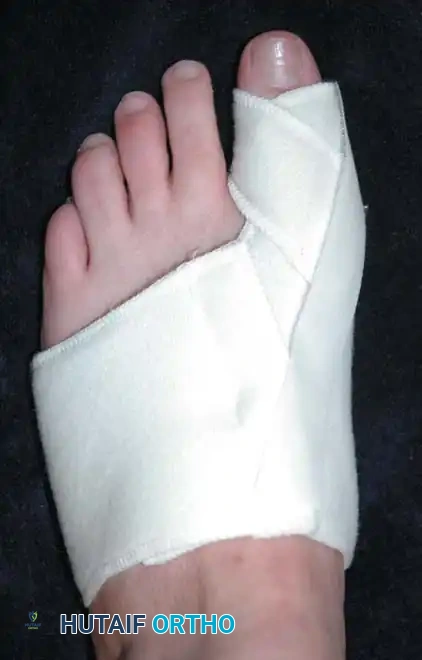 Disorders of the Hallux Surgical Diagram