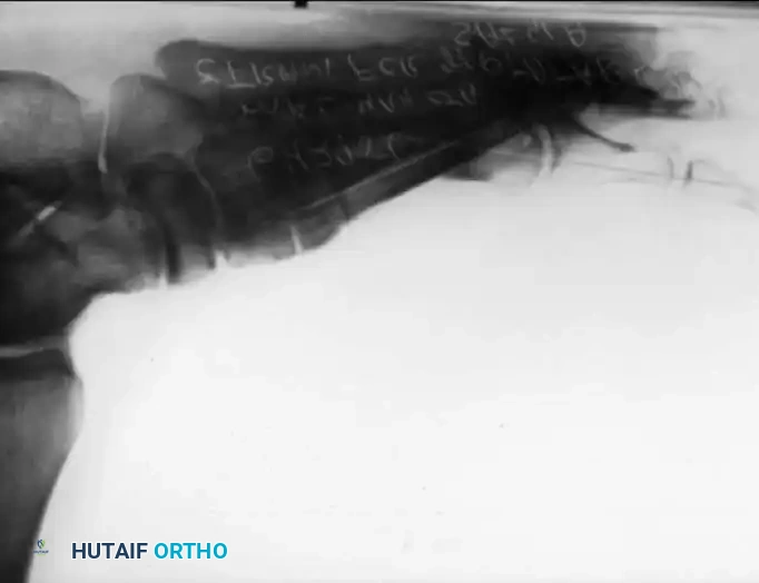 Disorders of the Hallux Surgical Diagram