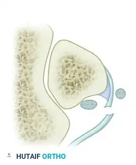 DISPLACEMENT OF TENDONS Surgical Diagram