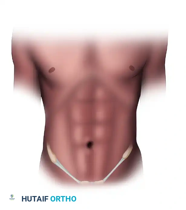 Gracilis and Rectus Abdominis Muscle Transfers: Operative Techniques