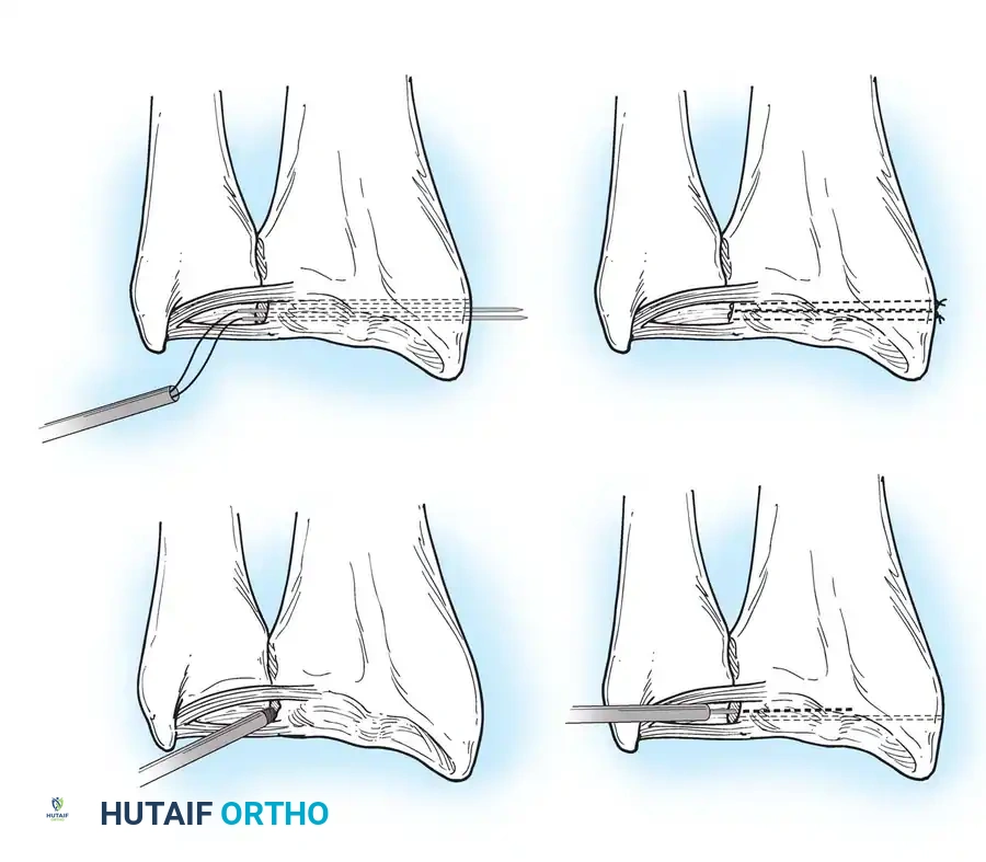 Hutaifortho's Orthopaedic Diagram
