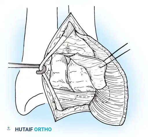 Hutaifortho's Orthopaedic Diagram