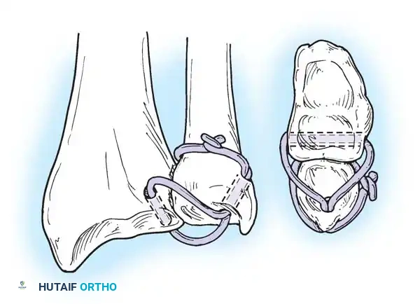 Hutaifortho's Orthopaedic Diagram