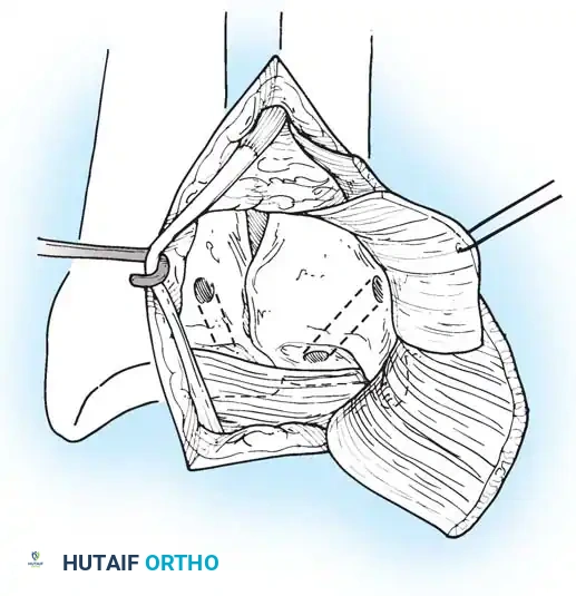 Hutaifortho's Orthopaedic Diagram