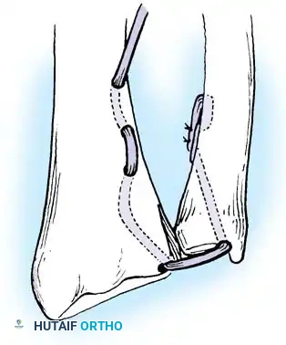 Hutaifortho's Orthopaedic Diagram