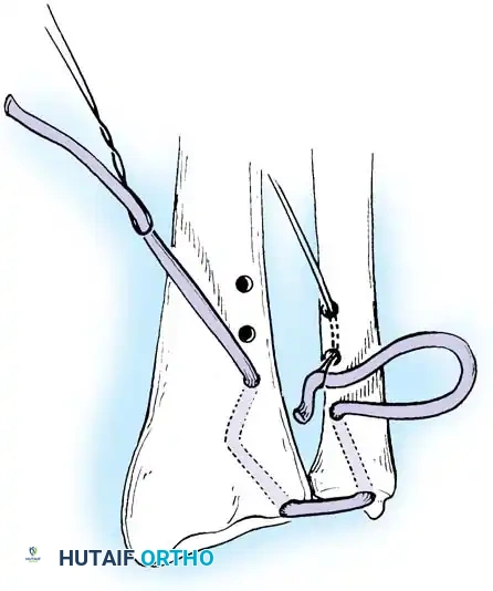 Hutaifortho's Orthopaedic Diagram