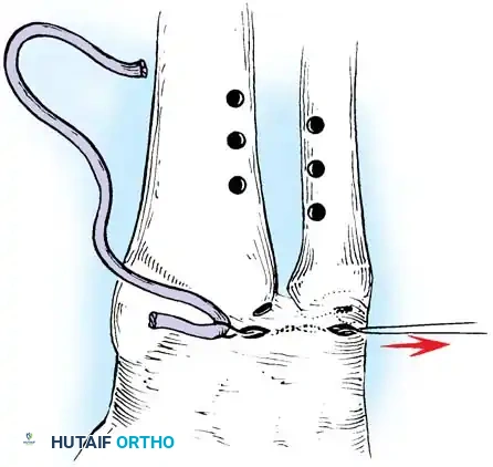 Hutaifortho's Orthopaedic Diagram