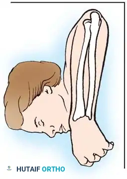Hutaifortho's Orthopaedic Diagram