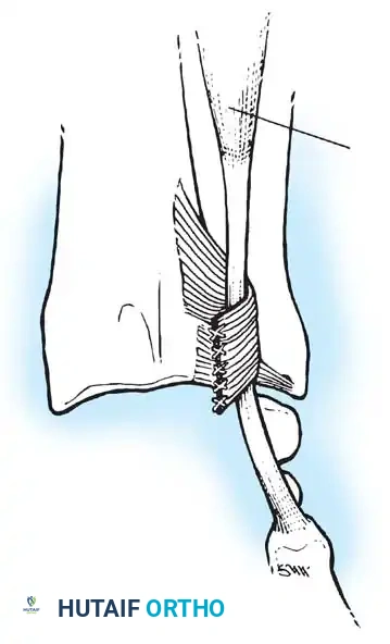 Hutaifortho's Orthopaedic Diagram