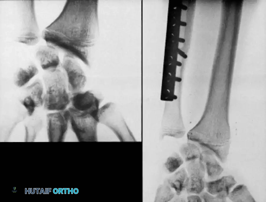 Hutaifortho's Orthopaedic Diagram