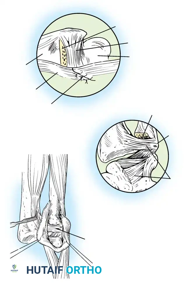 Hutaifortho's Orthopaedic Diagram