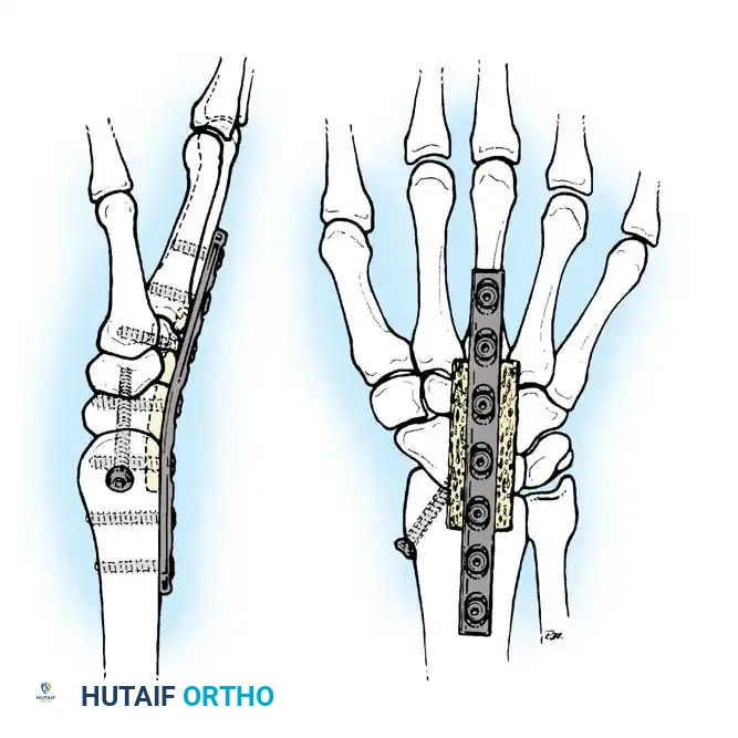 Hutaifortho's Orthopaedic Diagram