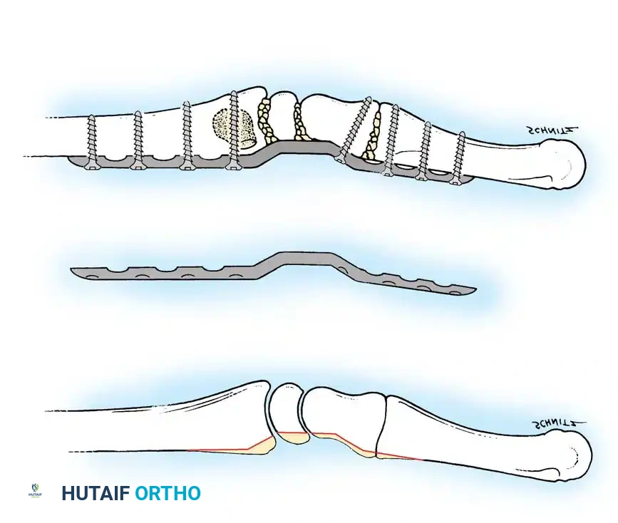 Hutaifortho's Orthopaedic Diagram