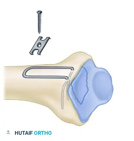 Hutaifortho's Orthopaedic Diagram