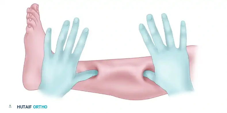 DOUBLE MINI-INCISION FASCIOTOMY FOR CHRONIC ANTERIOR COMPARTMENT SYNDROME Surgical Diagram