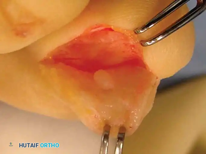 Hutaifortho's Orthopaedic Diagram