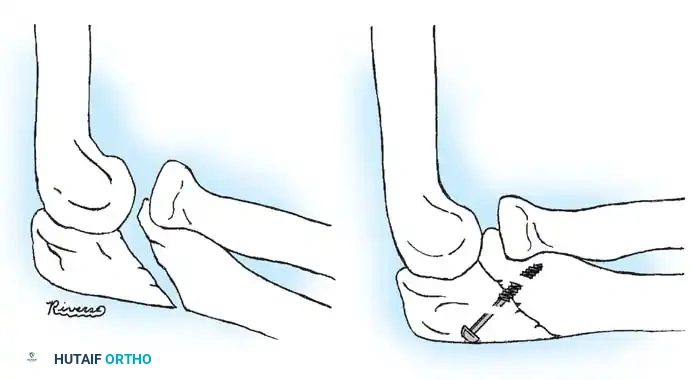 Hutaifortho's Orthopaedic Diagram