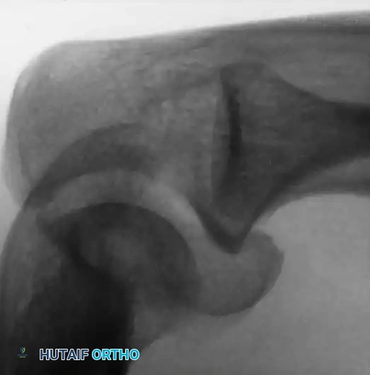 Hutaifortho's Orthopaedic Diagram